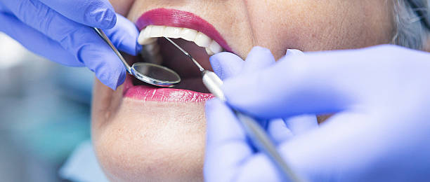 Best Emergency Root Canal Treatment in Oakwood Hls, IL